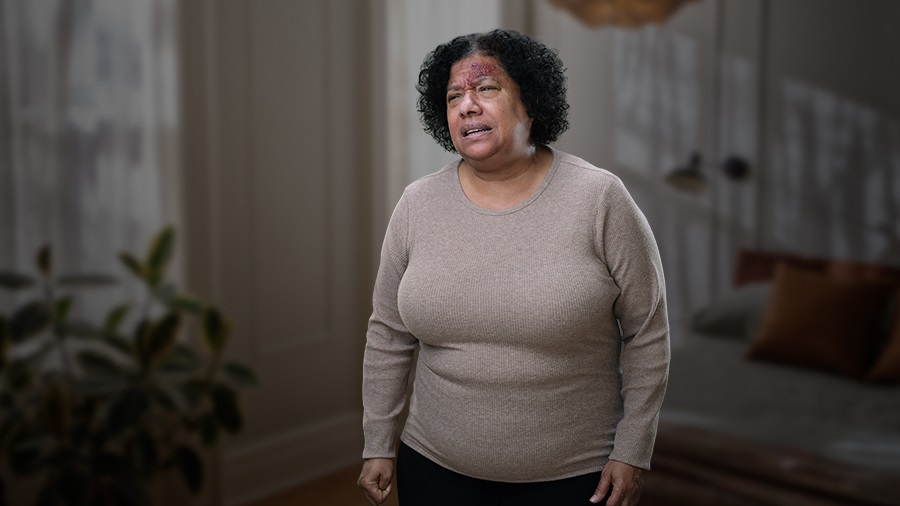 Woman with shingles pain